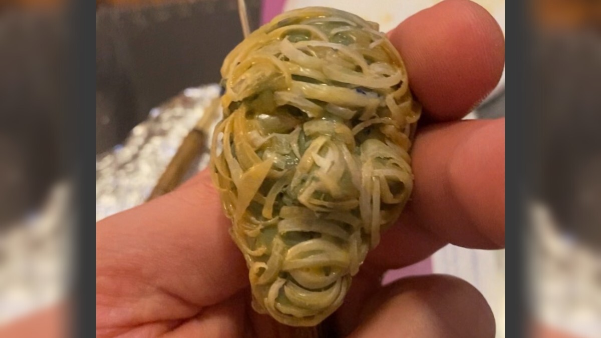 Philly-based artist wants your toenails to make a replica FIFA World Cup trophy